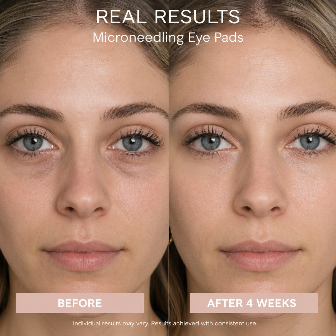 NEW! Ultraluxe Multi-Infusion MicroNeedling Eye Pads (Promotion for Multi-Pack version only starts 5/4 and ends 5/24)