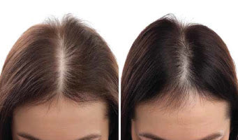 Ultraluxe RX Scalp Conditioner